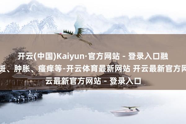 开云(中国)Kaiyun·官方网站 - 登录入口融会为皮肤的红斑、肿胀、瘙痒等-开云体育最新网站 开云最新官方网站 - 登录入口
